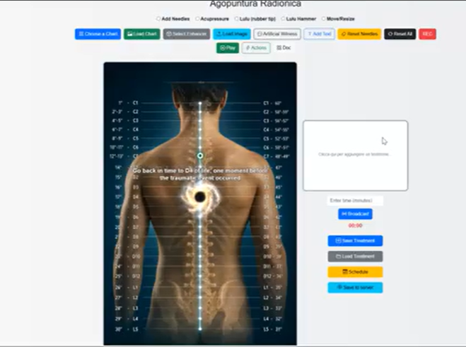 Radionics Acupuncture